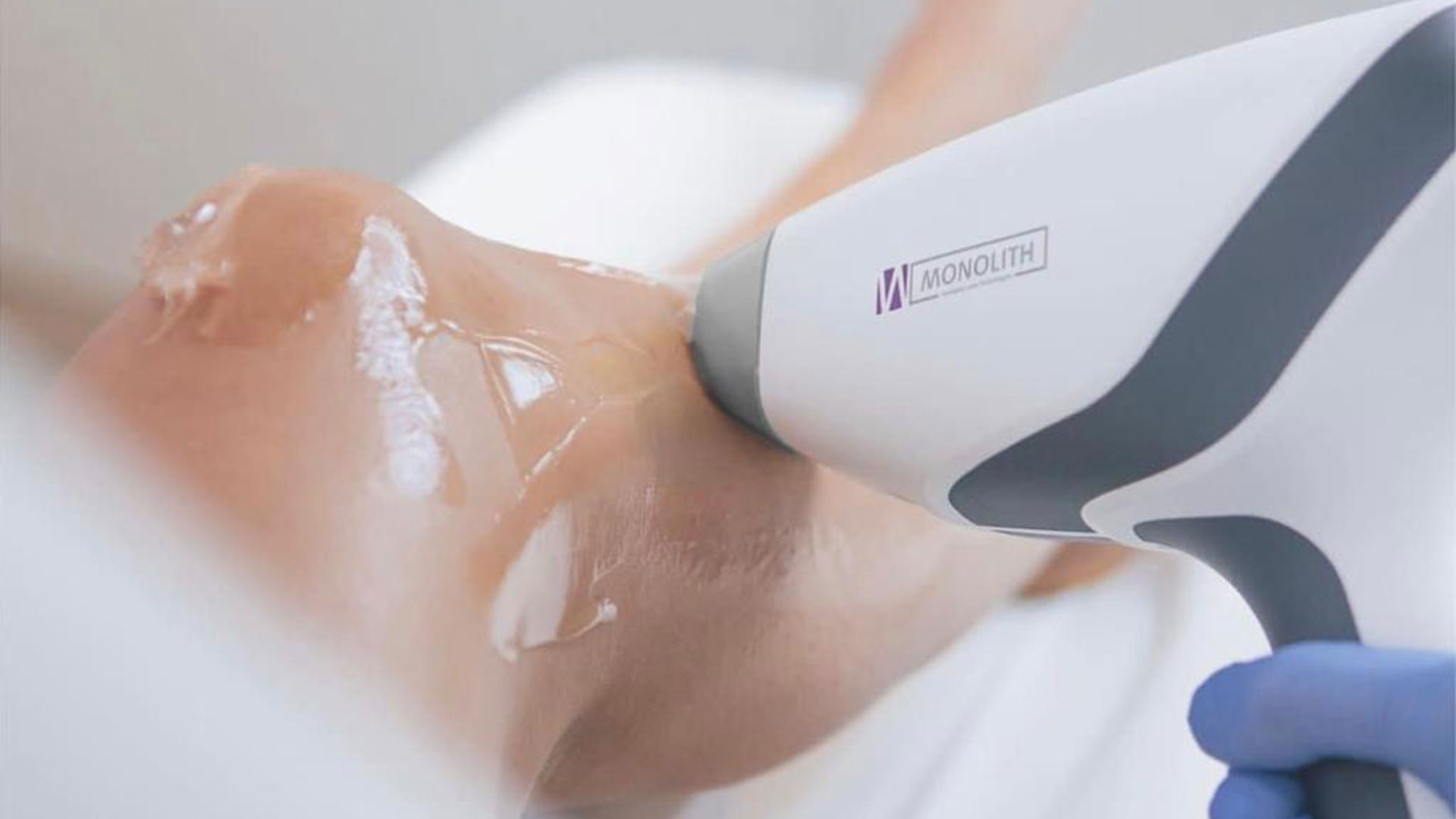 Haarentfernung bei der Frau